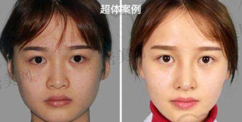 遇见许炎龙医生，开启变得更美之旅