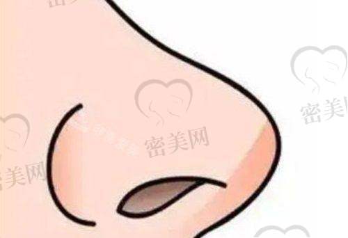 上海艺星许炎龙耳软骨隆鼻：精细技术优势大揭秘！