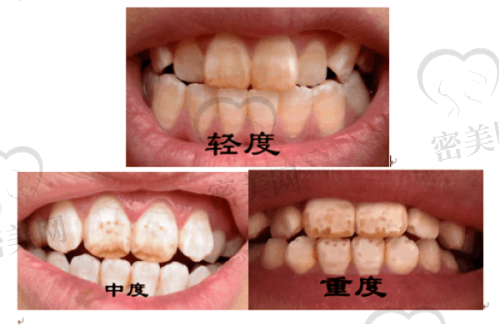 上海安信口腔门诊部怎么预约挂号？