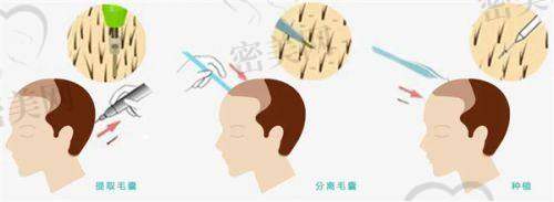 天津伊美尔瑞丽诗植发医疗中 心 - 和平区南京路