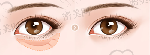 成浩医生口碑怎么样？