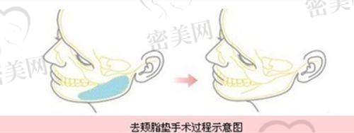 欧园萍医生怎么预约挂号？