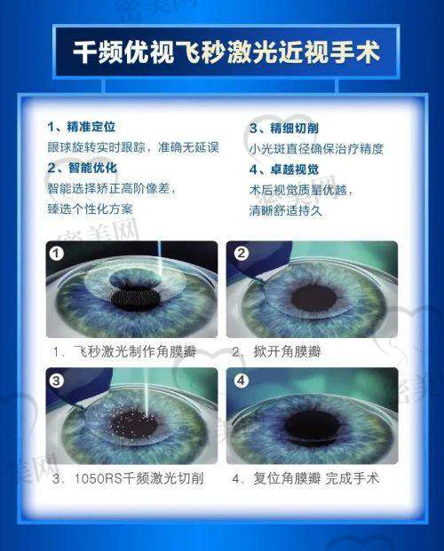 大连爱尔全飞秒值得选吗？3.0和4.0差别在哪？