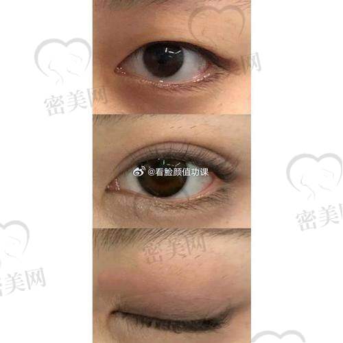 上海时光徐怀河医生成功实例大赏