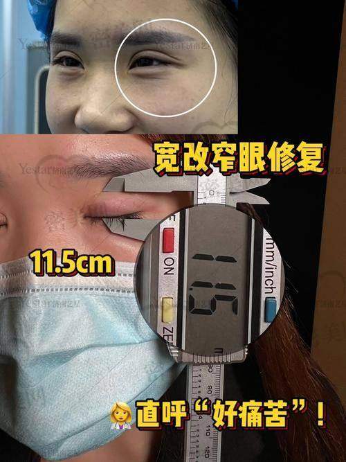 上海艺星整形李建兵医生：眼部修复界的超级明星