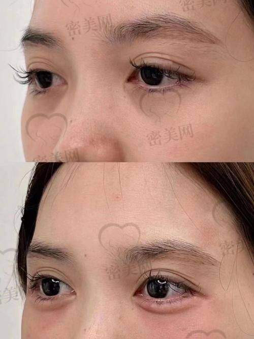 北京晶美魏志香：adm 卧蚕 26000 元起，价格亲民不肉疼