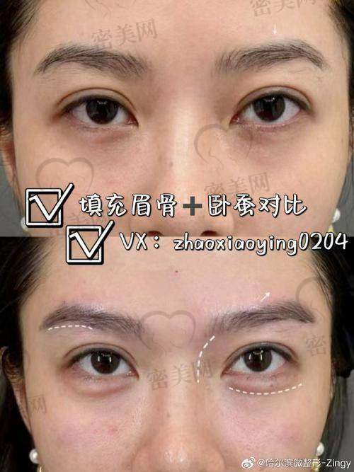 北京晶美医疗美容：卧蚕打造的“梦幻城堡”