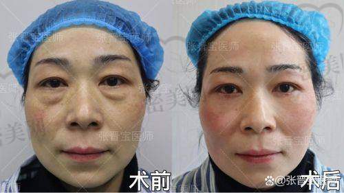 医生团队及服务体验——深圳美诗沁港丹值得信赖吗？