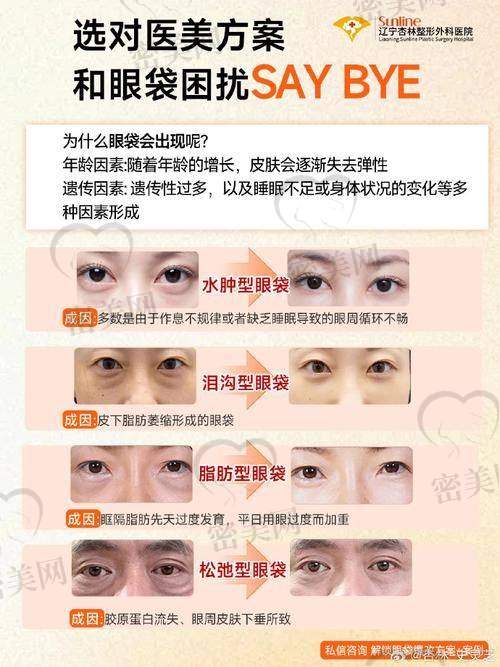 深圳美诗沁港丹医疗美容医院怎么样？23年只做眼袋真的名不虚传！