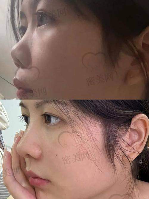 上海伯思立：美鼻背后的强大后盾