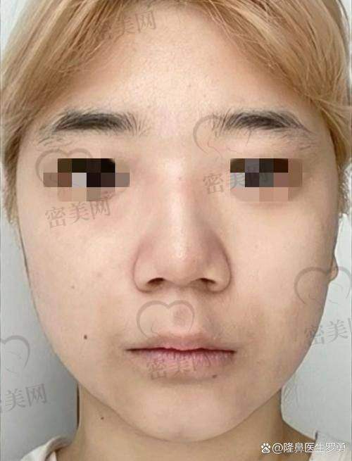 上海艺星：医美界的梦幻城堡，隆鼻项目超厉害！