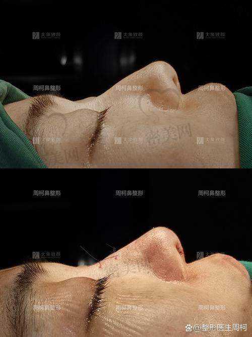 上海伯思立整形：鼻修复项目的“实力担当”