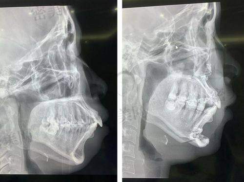 何晋龙正颌真人实例一览：医生口碑超炸裂