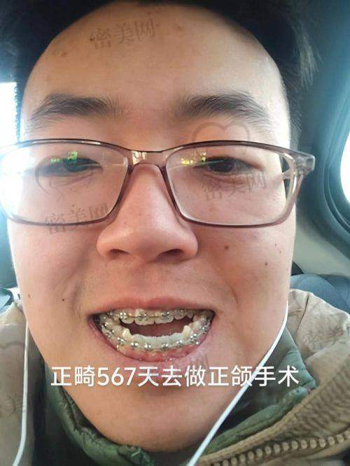 何晋龙正颌真人实例一览：技术优势超酷炫