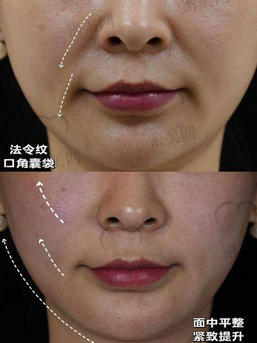 口腔和眼科相关小知识
