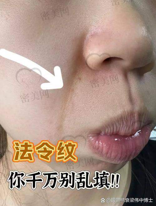 医美机构活动来啦