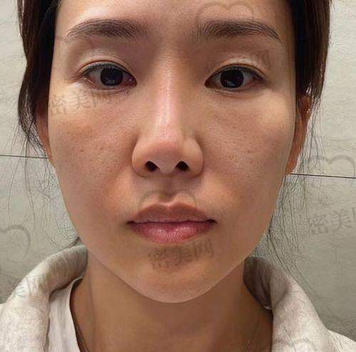 有啥注意事项？