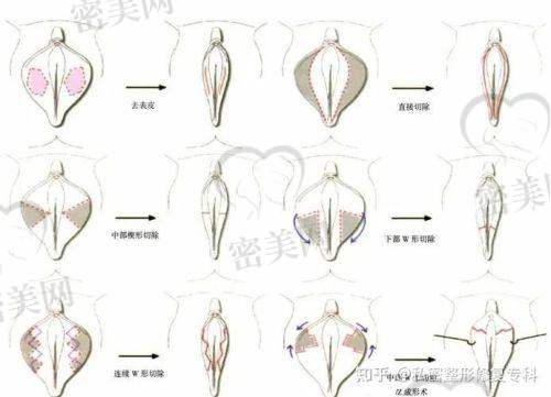 大连悦容医疗美容门诊部：私密定制方案的先行者
