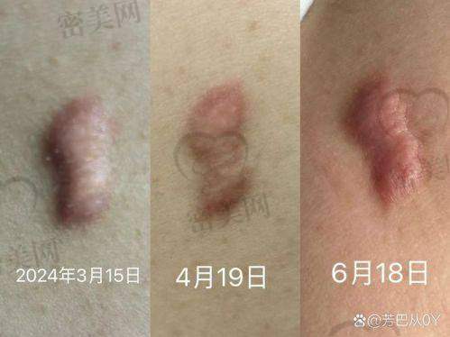 武汉协和医院皮肤科——大牌医院的专精风采