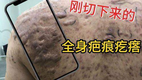 武汉亚韩整形美容医院皮肤科——专注美的疤痕治疗骨干医生