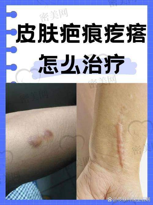 武汉仁爱医院皮肤科——亲民路线的贴心之选