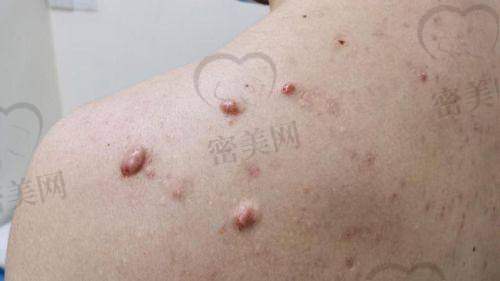 武汉艺星医疗美容医院皮肤科——时尚潮流的治疗选择