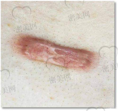 武汉同济医院皮肤科——学术先锋的治疗典范