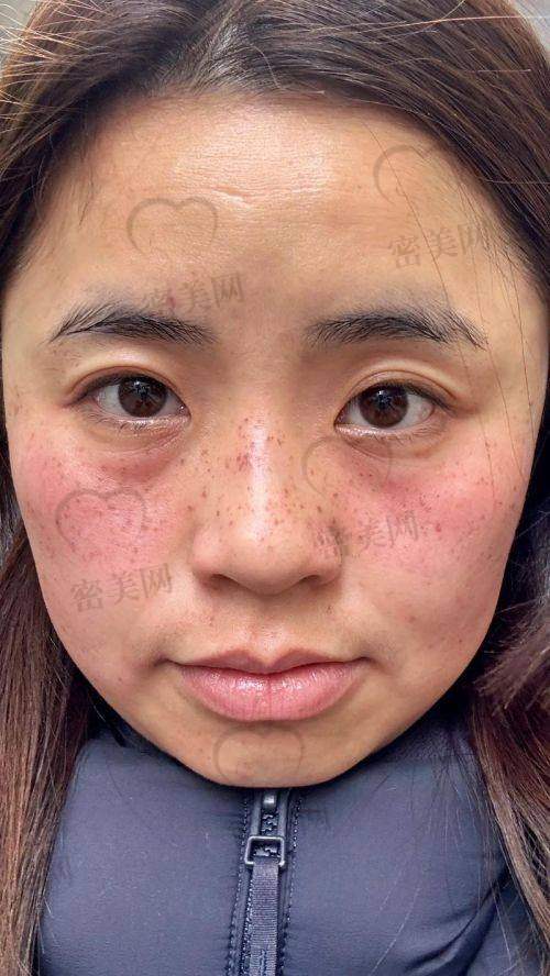广州红十字会医院患者人群与口碑状况