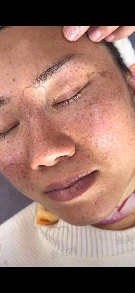 温馨提示：关于治疗次数与术后养护建议