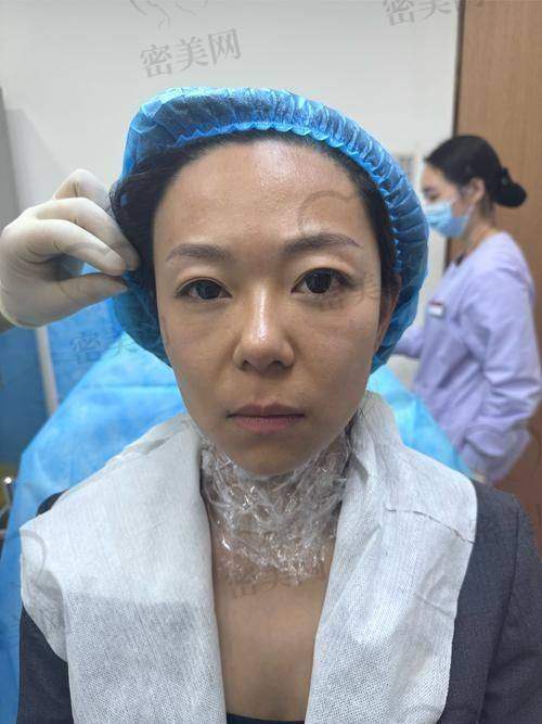 填充后有凸起咋办