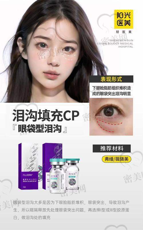 玻尿酸泪沟填充一般要多少钱
