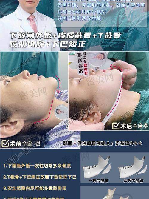 上海时光何晋龙磨骨多少钱：收费标准大公开