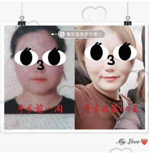 上海时光整形外科医院——磨骨界的“网红”