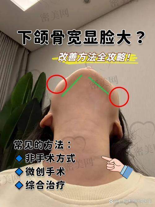 广州美恩整形美容医院——磨骨新势力