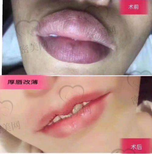 广州晶美医疗美容医院：眼鼻精细化雕刻小而美