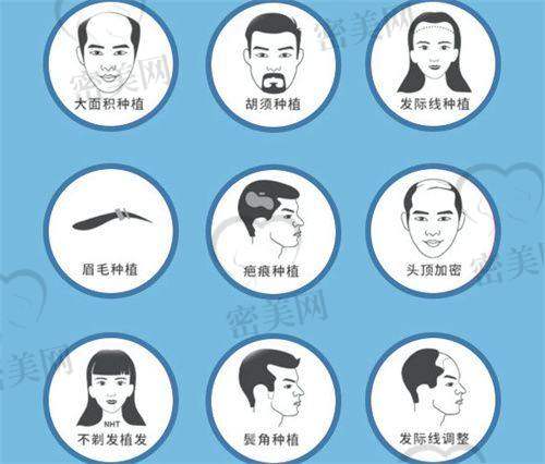 江苏百年植发医生团队：经验多，手法稳定