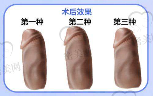 马晶晶医生口碑怎么样？