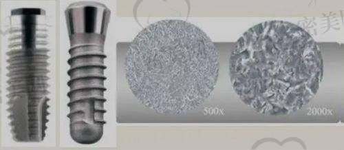 镇江维乐口腔：种植牙3980元起，高端品牌全覆盖