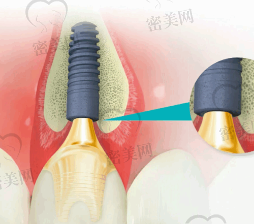 上海均兴口腔门诊部价格表：