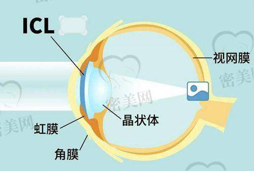 临沂市人民医院眼科特色项目有哪些?