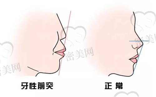 广州美莱医疗美容医院：国内连锁巨头，皮肤修复强项