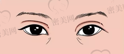2. 深圳宝丽整形：你对“鼻子”的所有期待，他们都懂
