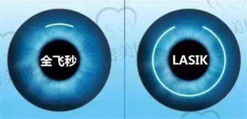 贵阳康视眼科医院的优惠活动+性价比解析