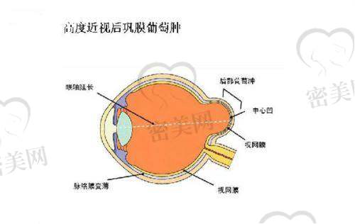 白内障、青光眼手术项目费用:白内障手术较低3000元起,多焦点晶体近5万