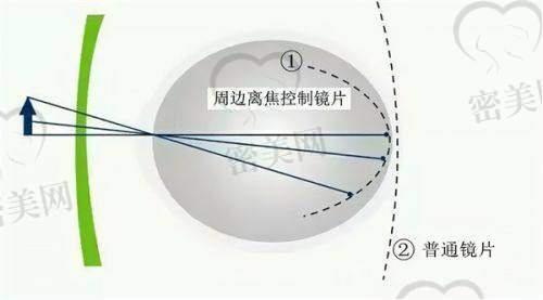 万州爱尔眼科全飞秒激光手术：性价比较高，年轻人优选
