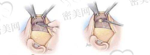 温志刚医生口碑怎么样？
