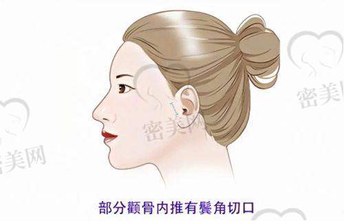 术后服务怎么样?“海底捞级别”的贴心照顾