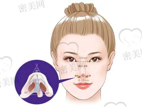广州华美医疗美容医院：脂肪整形先锋派