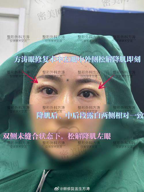 北京晶美医疗美容：双眼皮修复的理想之选