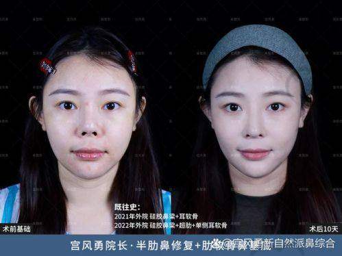 手术：紧张与期待并存